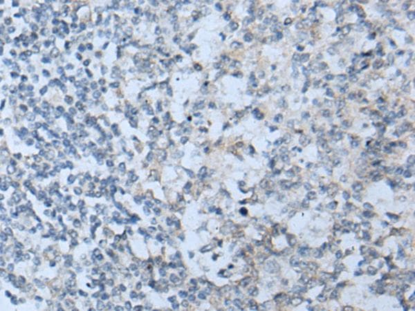 STARD4 Antibody