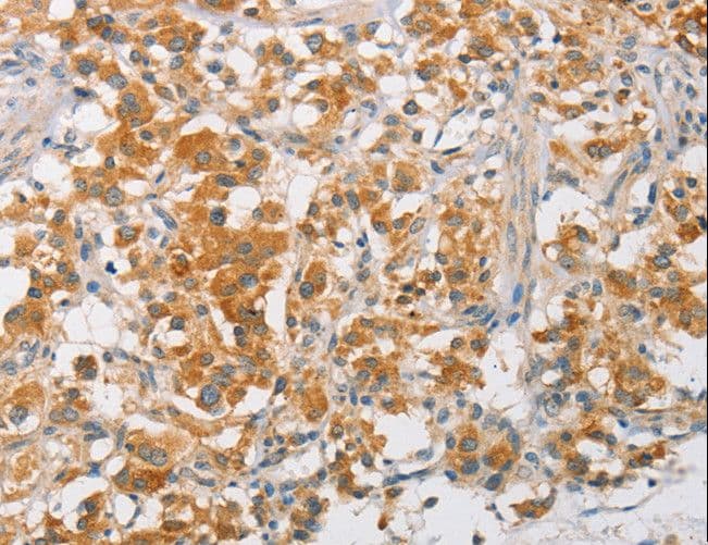 Polyclonal Rabbit anti-Human ARMCX3 Antibody (IHC, WB)