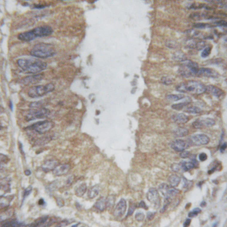 Polyclonal Rabbit anti-Human PLA2G4A Antibody (IHC, IF, WB)
