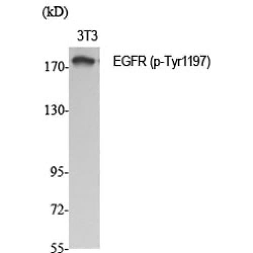 Polyclonal Rabbit anti-Human EGFR Antibody (1120-1200 aa, IHC, WB)