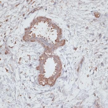 Polyclonal Rabbit anti-Human TGFBR2 Antibody (IHC, IF)