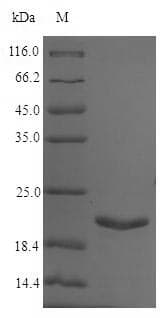 Salmonella typhi uspA Protein (Recombinant 6His, N-terminus)