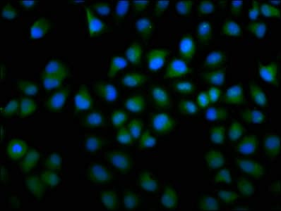 IHC-plus™ F13A1 / Factor XIIIa Antibody