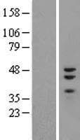 Human ZNF3 Protein (Over-Expression Lysate Myc-DDK (Flag))