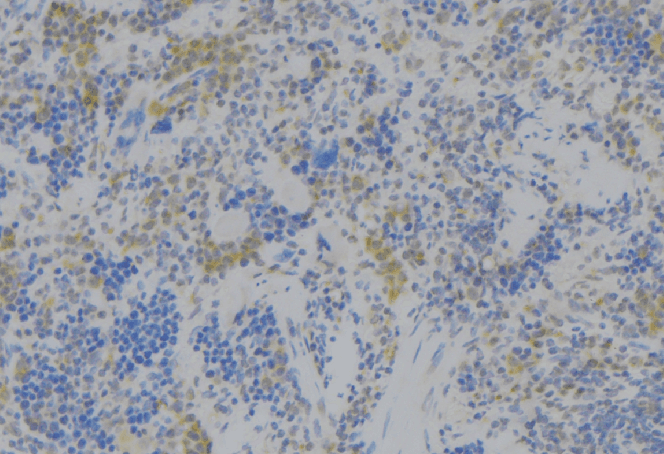 RAB27B Antibody