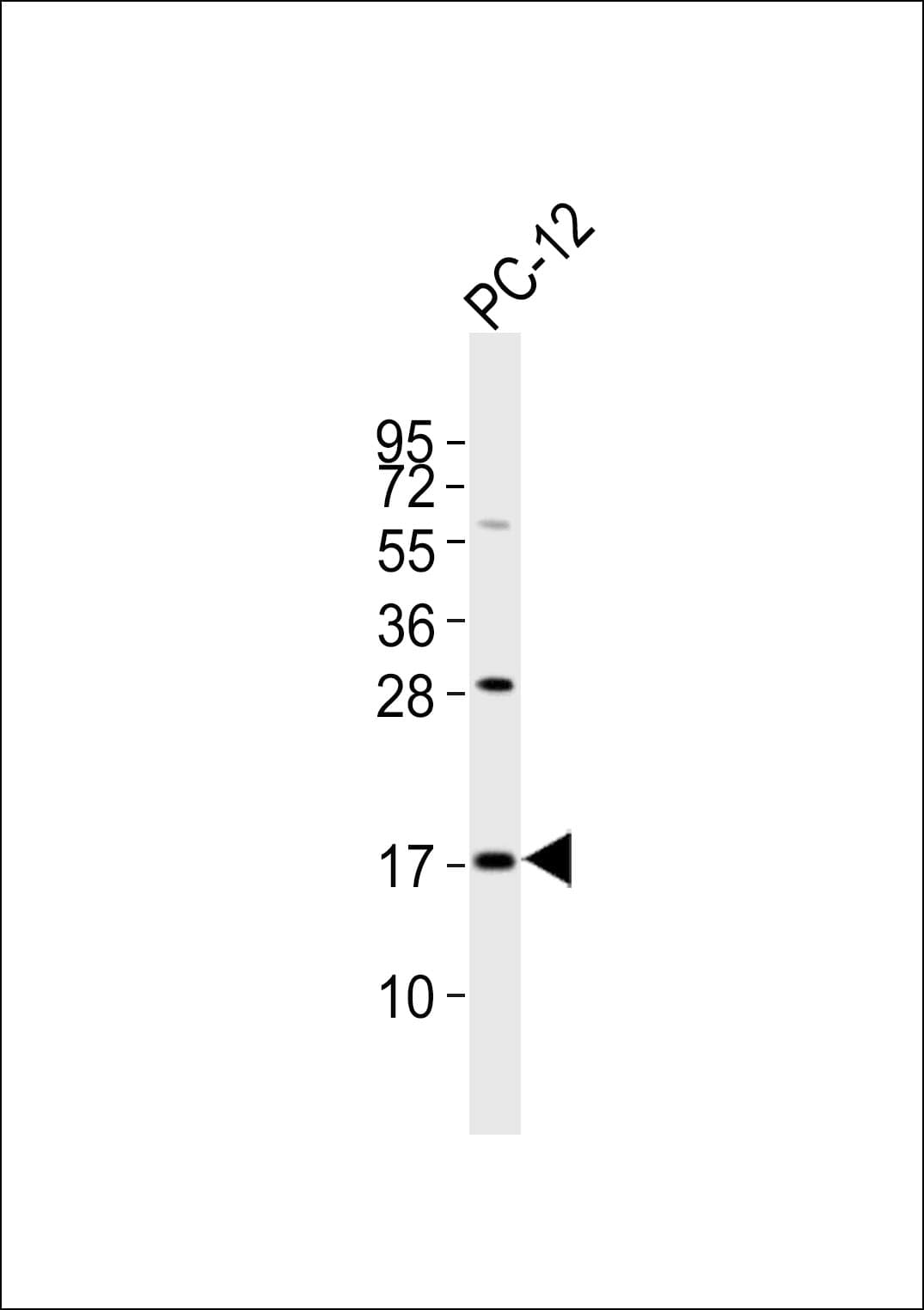 Polyclonal Rabbit anti-Human SFT2D2 Antibody (WB)
