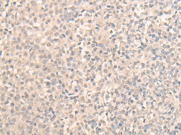 Polyclonal Rabbit anti-Human DDX59 Antibody (IHC, WB)