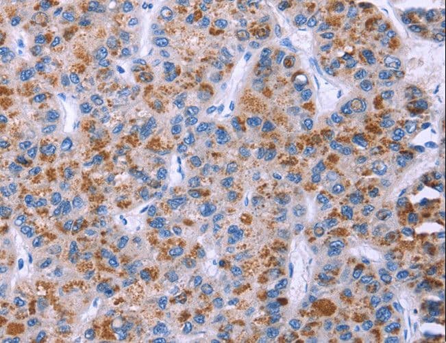 Polyclonal Rabbit anti-Human ESPL1 / Separase Antibody (IHC)