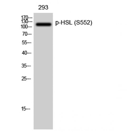 Polyclonal Rabbit anti-Human LIPE / HSL Antibody (490-570 aa, IHC, WB)