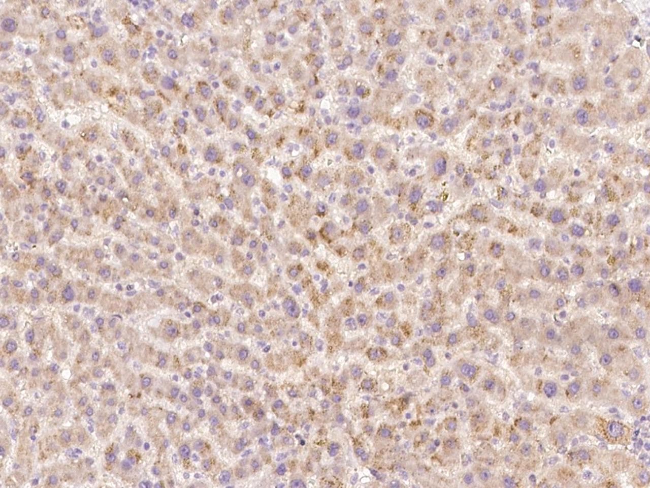 HGF / Hepatocyte Growth Factor Antibody (Preservative Free)
