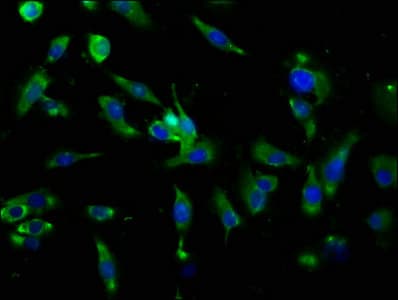 AQP4 / Aquaporin 4 Antibody (aa253-323)