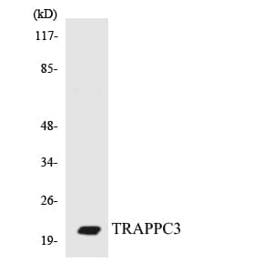 Polyclonal Rabbit anti-Human TRAPPC3 Antibody (aa127-176, WB)