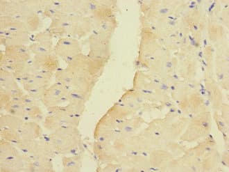 Polyclonal Rabbit anti-Human PDK3 Antibody (IHC, WB)