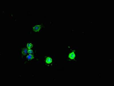 PCBD1 / PHS Antibody