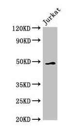 GABPB2 Antibody