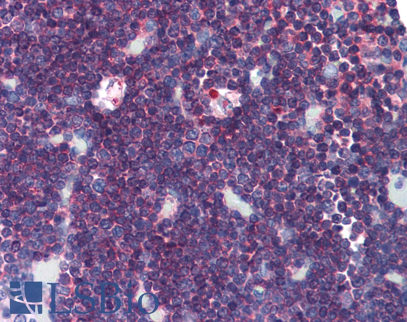 IHC-plus™ CD45 / LCA Antibody (clone F10-89-4, FITC)