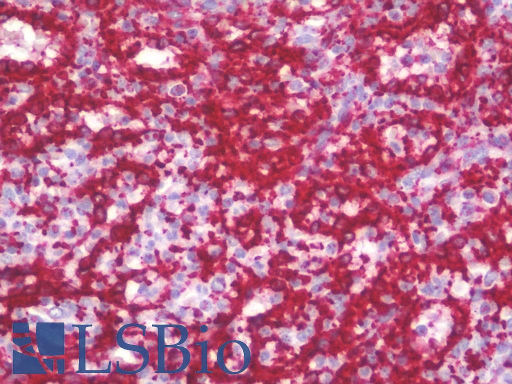 IHC-plus™ Polyclonal Rabbit anti-Human PTRF / CAVIN Antibody (IHC, IF, WB)