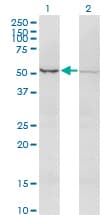 Monoclonal Mouse anti-Human ACTRIIB / ACVR2B Antibody (clone 1C11, WB)