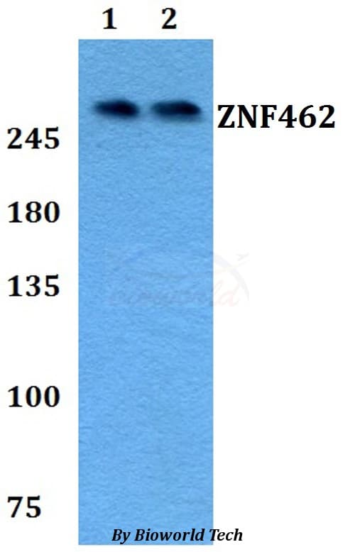 Polyclonal Rabbit anti-Human ZNF462 Antibody (WB)