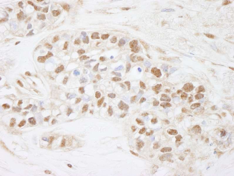 Polyclonal Rabbit anti-Human CDC25C Antibody (aa150-200, IHC)