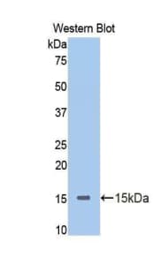 SERPINA6 / CBG Antibody (aa35-140)