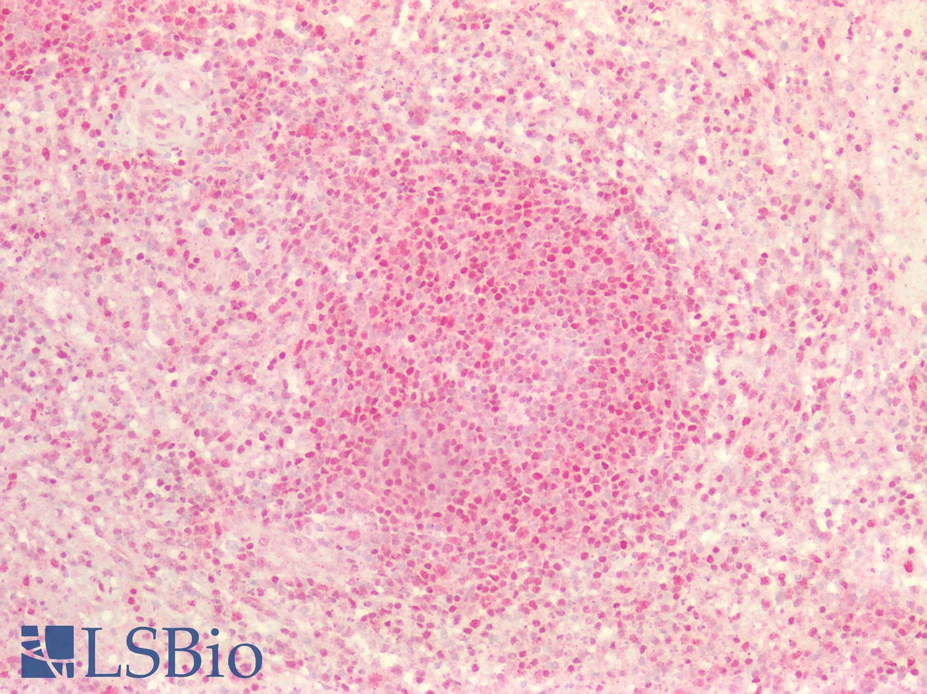 PathPlus™ Polyclonal Rabbit anti-Human MAX Antibody (aa110-160, IHC, WB)