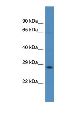 FMR1 / FMRP Antibody (C-Terminus)
