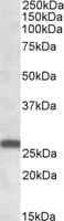IHC-plus™ MOB4 / PHOCN Antibody (aa116-130)