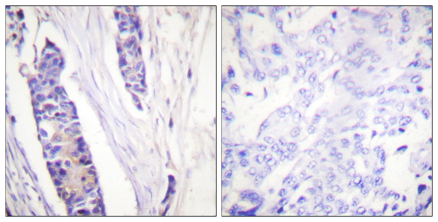 Polyclonal Rabbit anti-Human Beta Tubulin Antibody (IHC, WB)