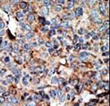 NME2 Antibody (aa25-54)