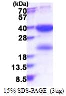 Human SKA1 Protein (Recombinant His)