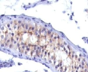 PRLR / Prolactin Receptor Antibody (clone PRLR742, Ready-to-Use)
