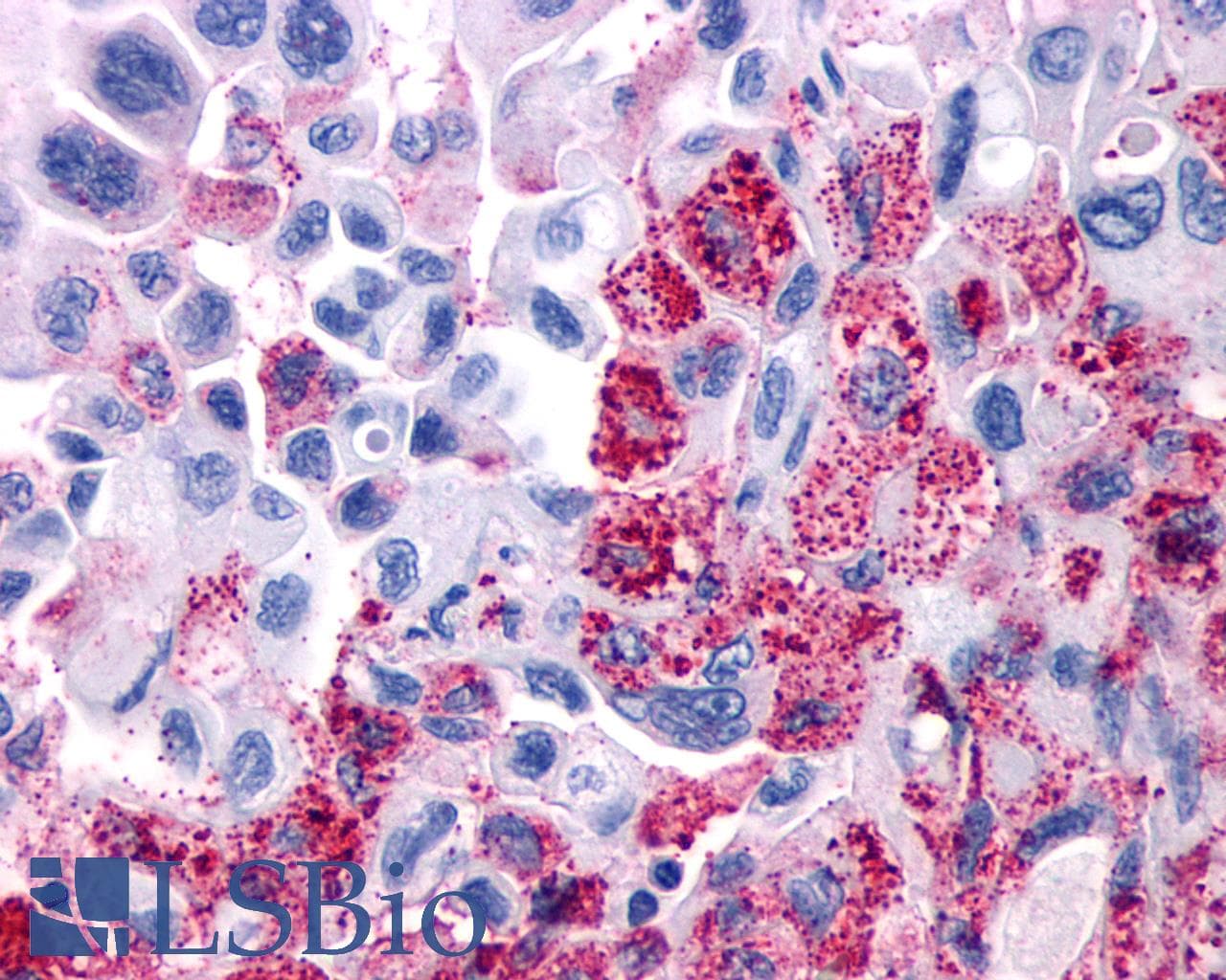 IHC-plus™ VIPR1 Antibody (Cytoplasmic Domain)