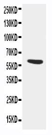 Alpha-1-Antichymotrypsin Antibody (aa218-232)