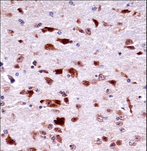 PHKG2 Antibody (aa2-29)