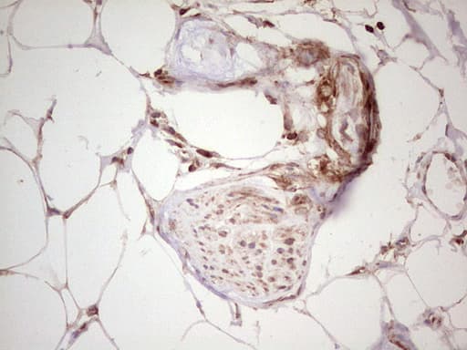 Monoclonal Mouse anti-Human WIBG Antibody (clone OTI5E2, IHC, WB)