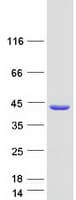 Human CLTB Protein (Recombinant Myc-DDK (Flag))