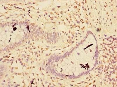 Polyclonal Rabbit anti-Human RNF181 Antibody (IHC)
