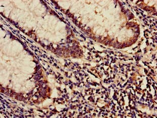KARS Antibody