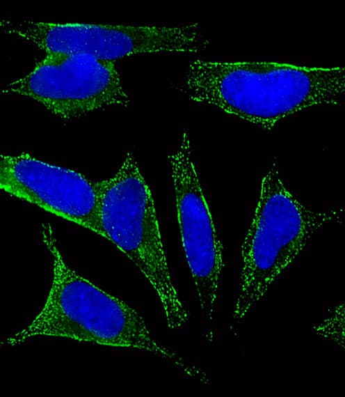 CHRM2 / M2 Antibody (clone 1424CT461.78.60)