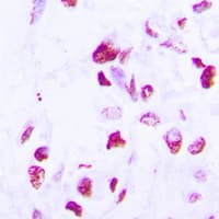 CEBPD + CEBPE Antibody (C-Terminus)