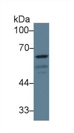 GAD1 / GAD67 Antibody (aa1-97, Cy3)