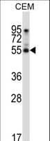 PALMD Antibody (aa41-69)