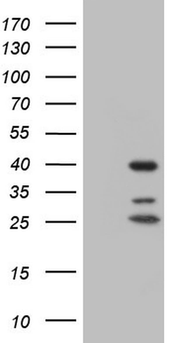 NR1I3 / CAR Antibody (aa1-236, clone OTI10F9)