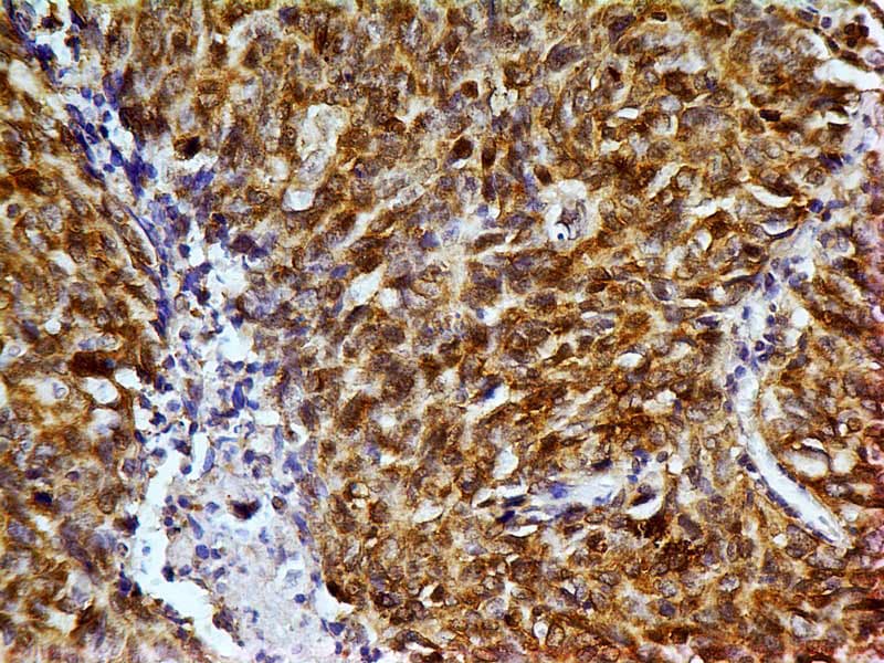 MSI2 Antibody