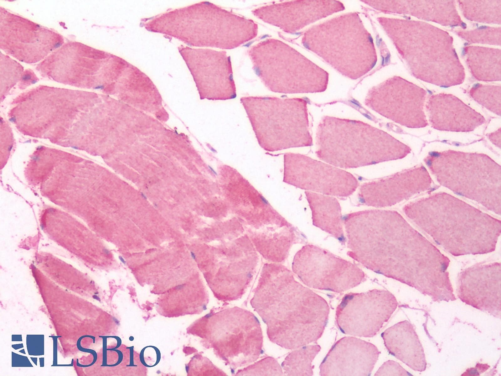IHC-plus™ UCHL3 Antibody (Internal)