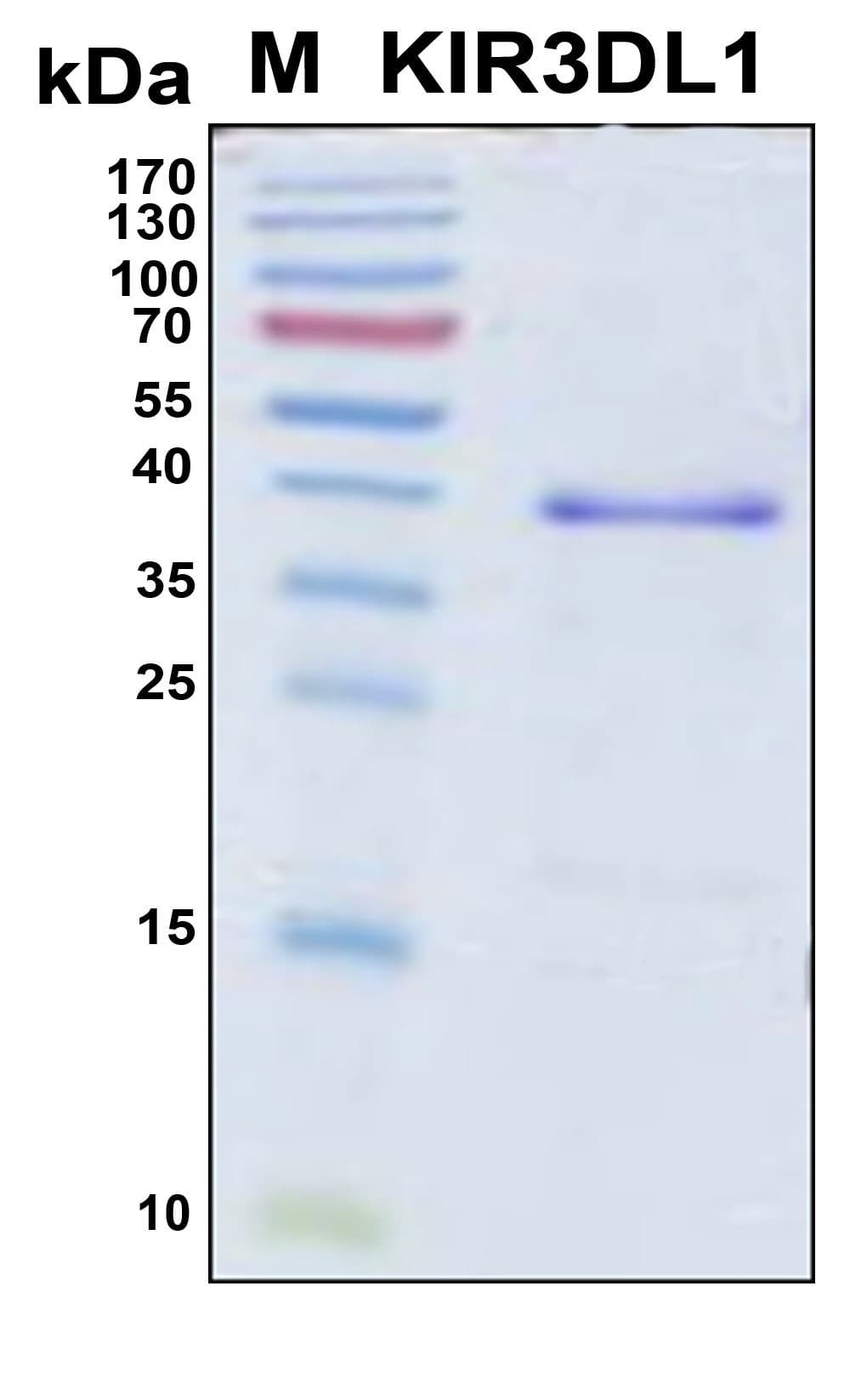 Human KIR3DL1 Protein (Recombinant 6His, N-terminus)