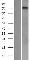 PLCB1 / Phospholipase C Beta 1 Protein (Over-Expression Lysate Myc-DDK (Flag))