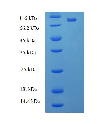 Human DDX19A Protein (Recombinant His-SUMO)