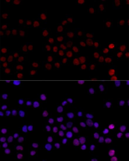 HNRNPL / hnRNP L Antibody
